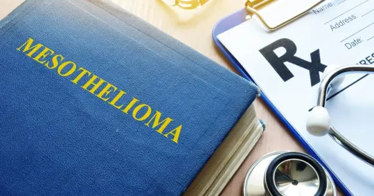 mesothelioma diagnosis